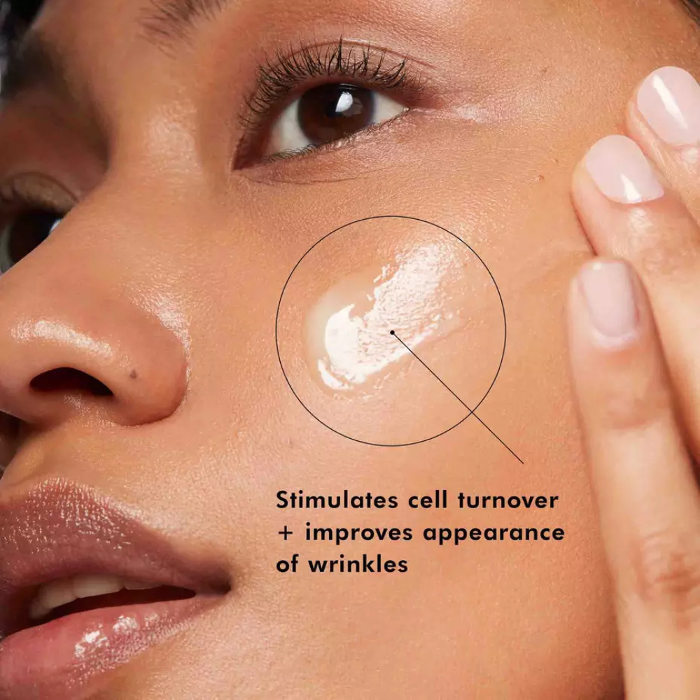 Woman applying retinol serum to her oily, acne-prone skin